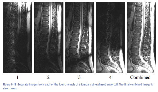 Spine Array