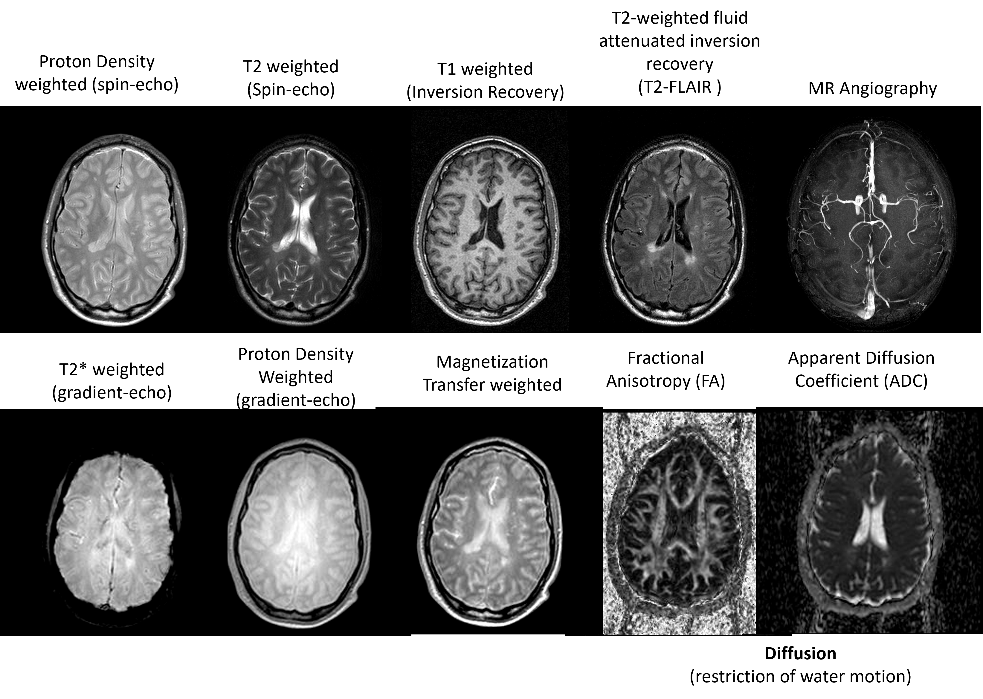 Brain contrast from Vasily Yarnkh
