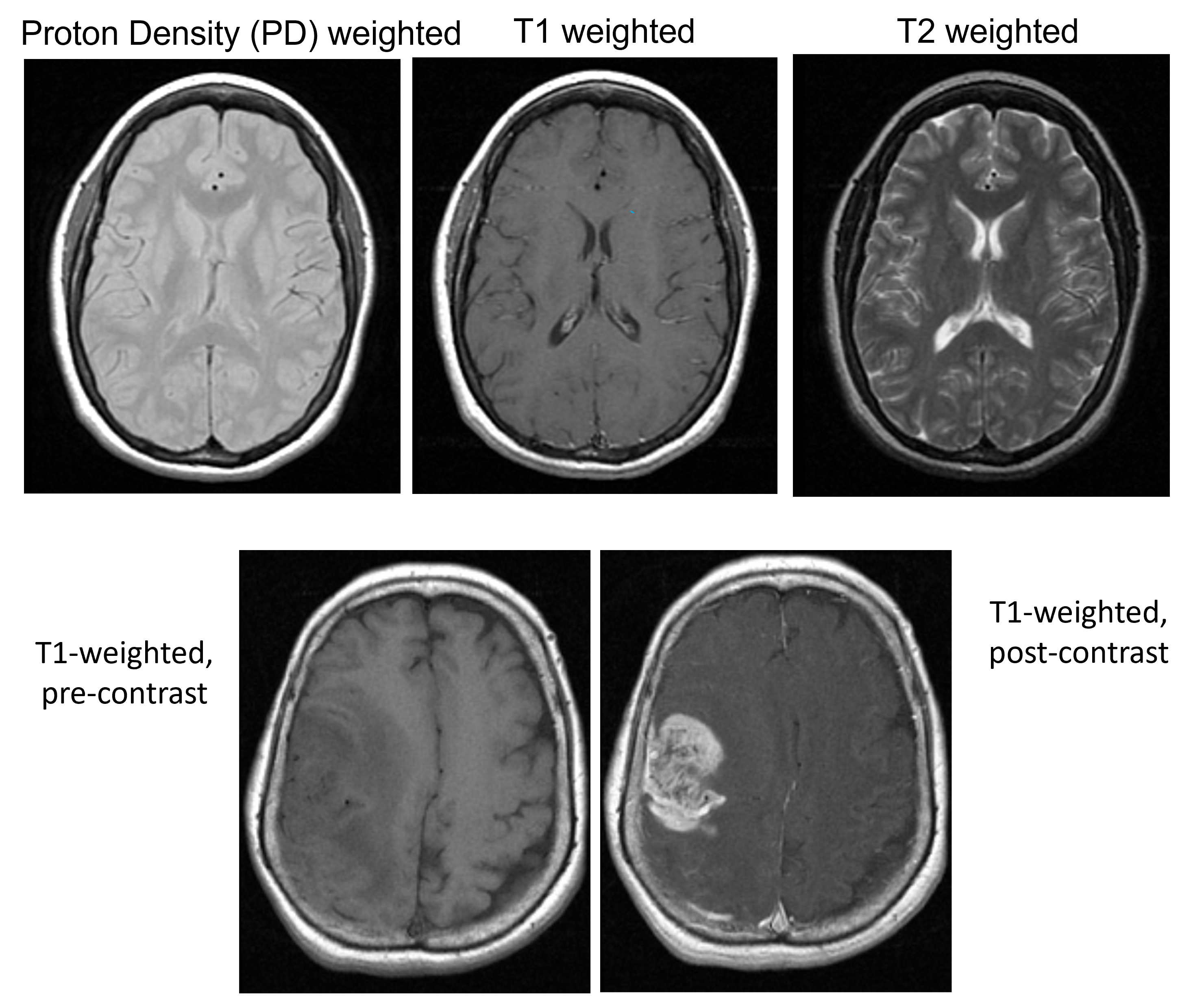 Brain contrast from Pauly and Gold