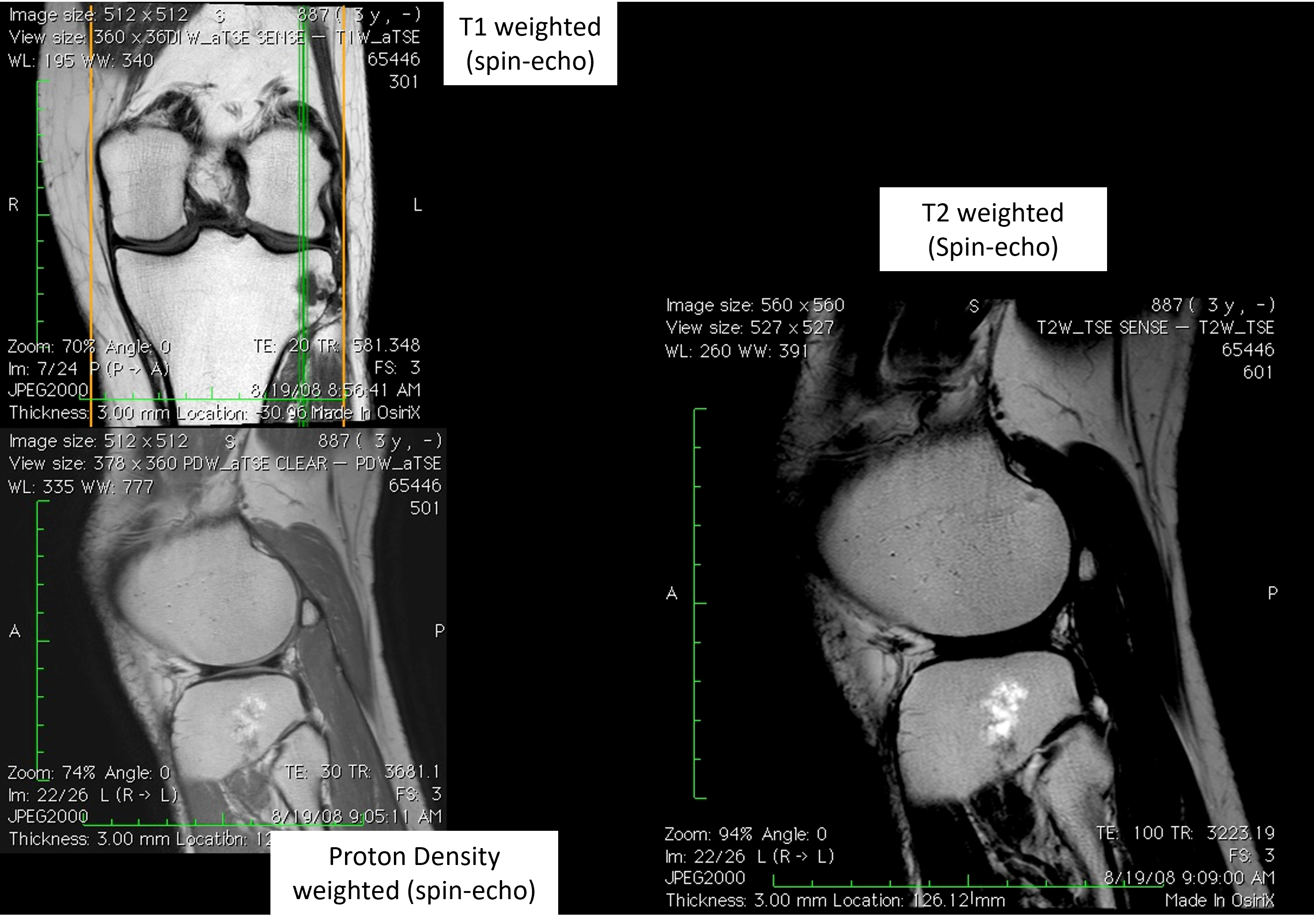 Knee contrast