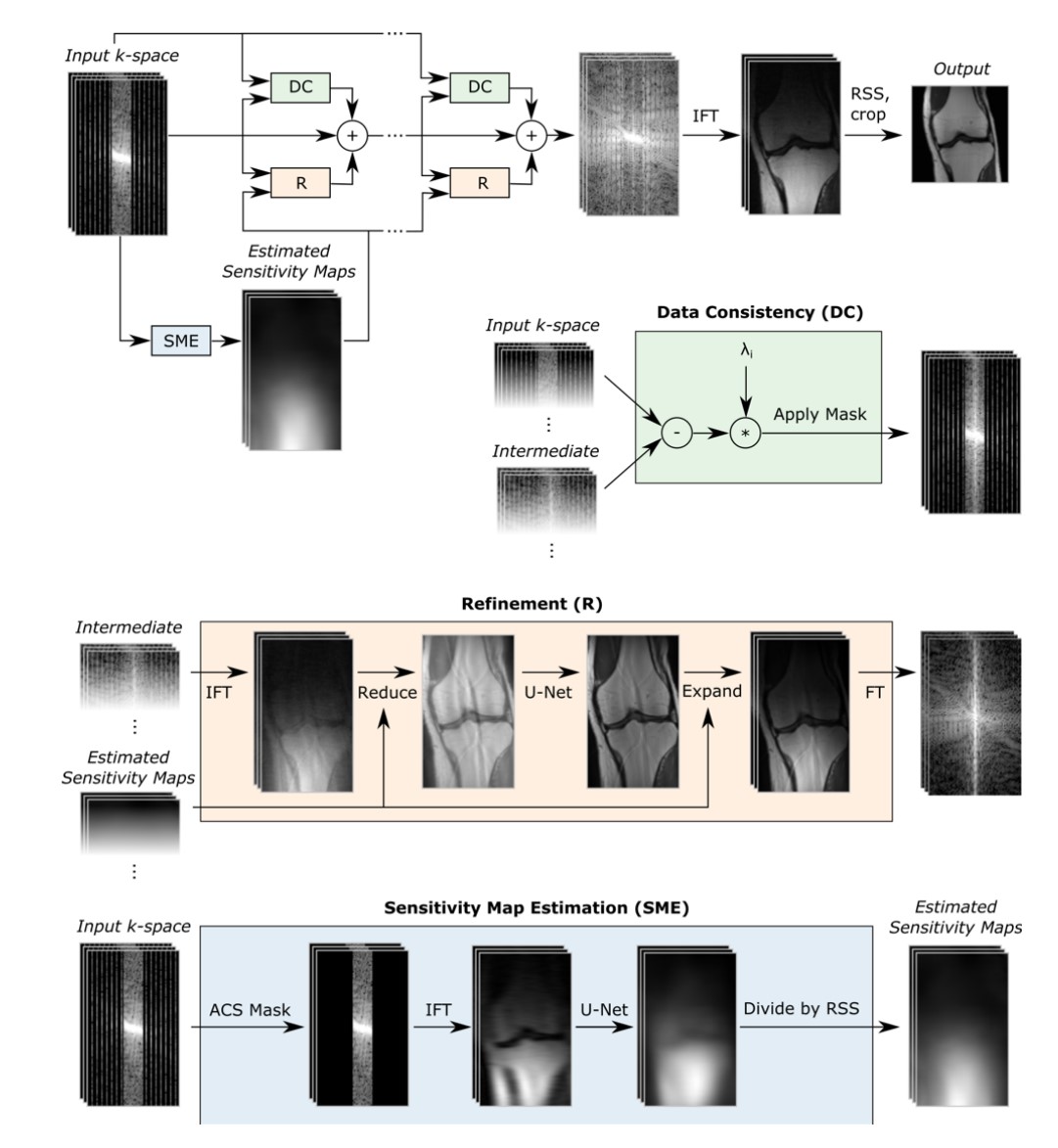 Variational Network for MRI Reconstruction