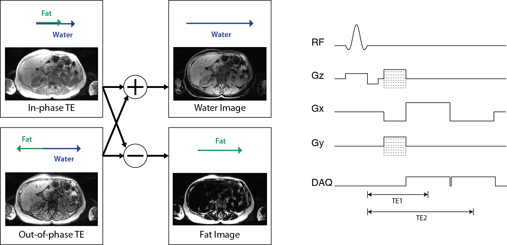 Fat/water imaging illustration