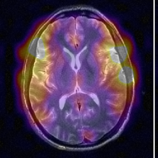 Hyperpolarized 13C Brain MRI