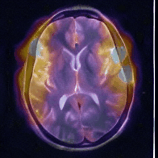 Hyperpolarized 13C Brain MRI Spaceship animation