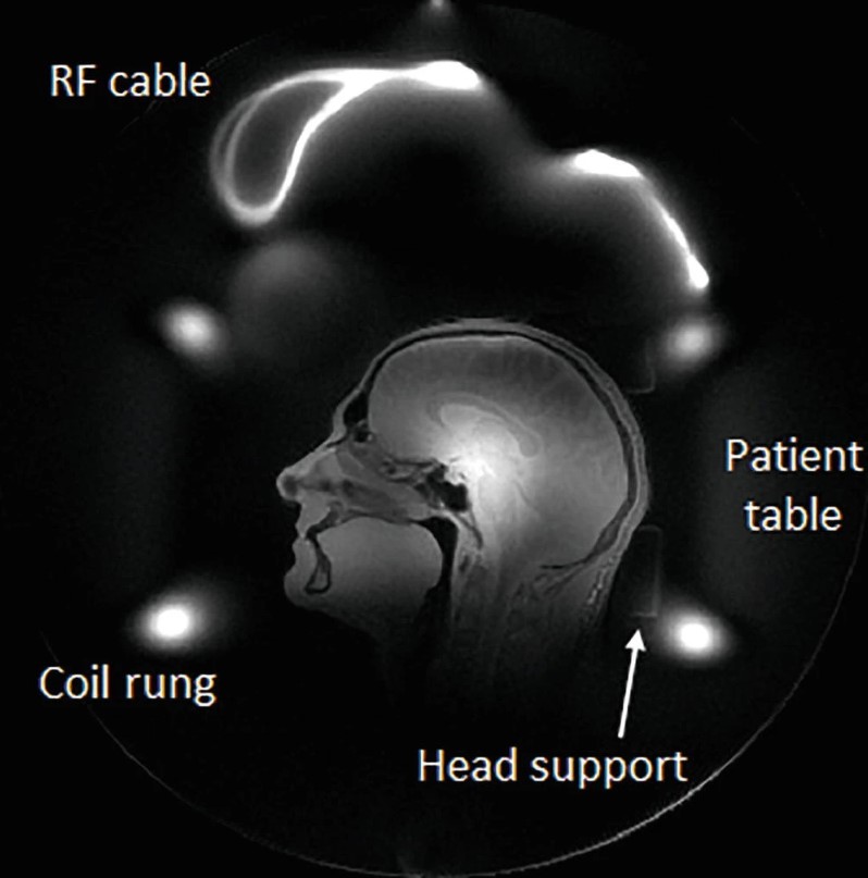 RF coils and housing