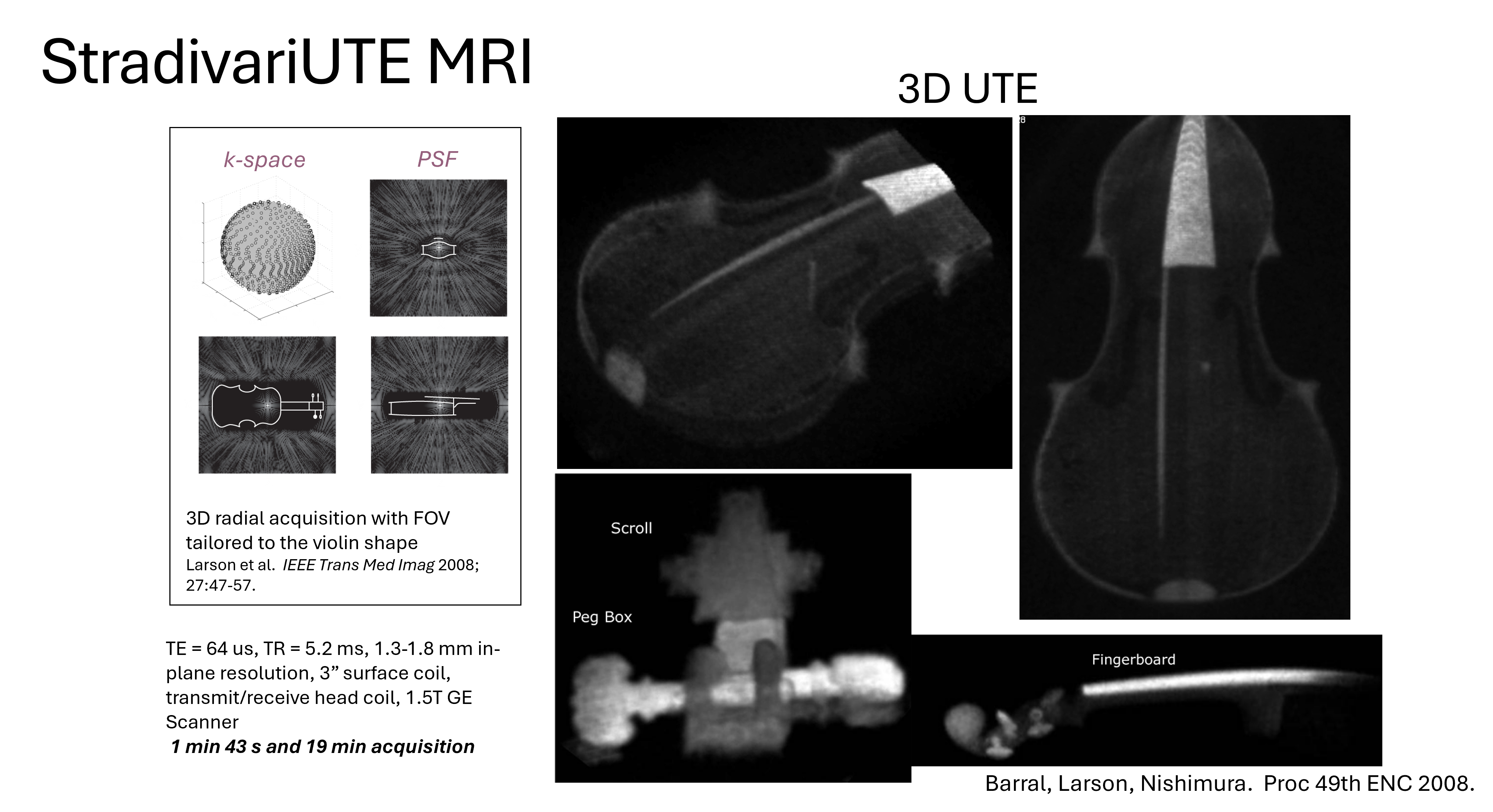 Violin MRI